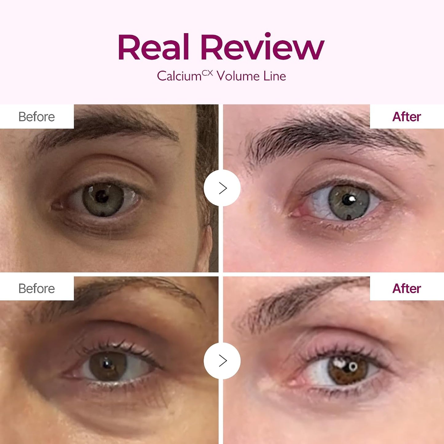 Dr.Melaxin Calcium Intense Firming Cream