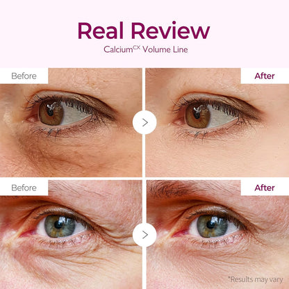 Dr.Melaxin Calcium Volume Under Eye Patches