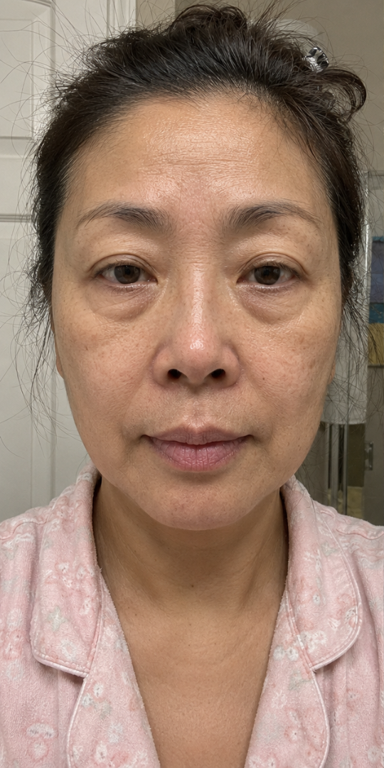 gpdp-md-27-ba2-before